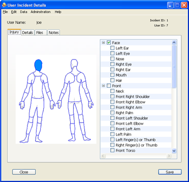 Incident User Injury Window